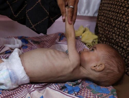 Gaza | Manca tutto, a partire dalle prime opere di misericordia