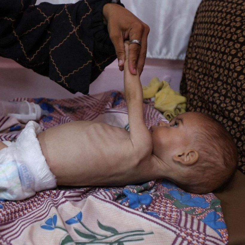 Gaza | Manca tutto, a partire dalle prime opere di misericordia
